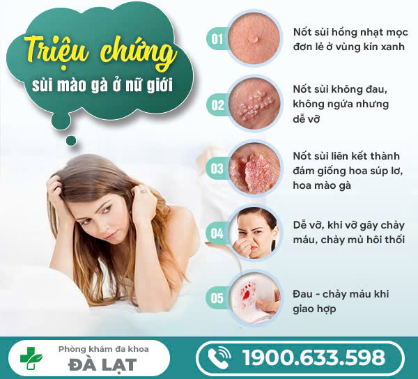 Hình ảnh minh họa
